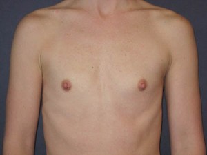 Pre op anterior view