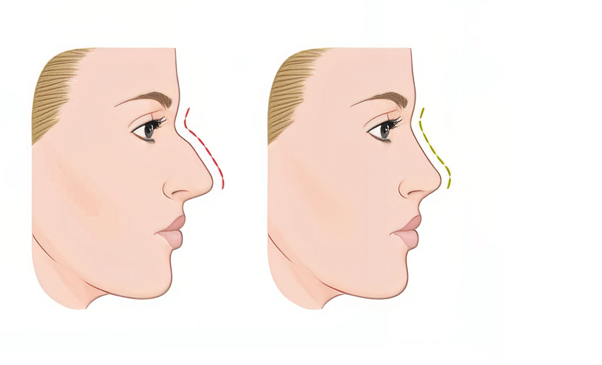 shutterstock 243030061 1